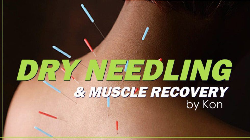 Dry Needling & Muscle Recovery - ProPhysio+