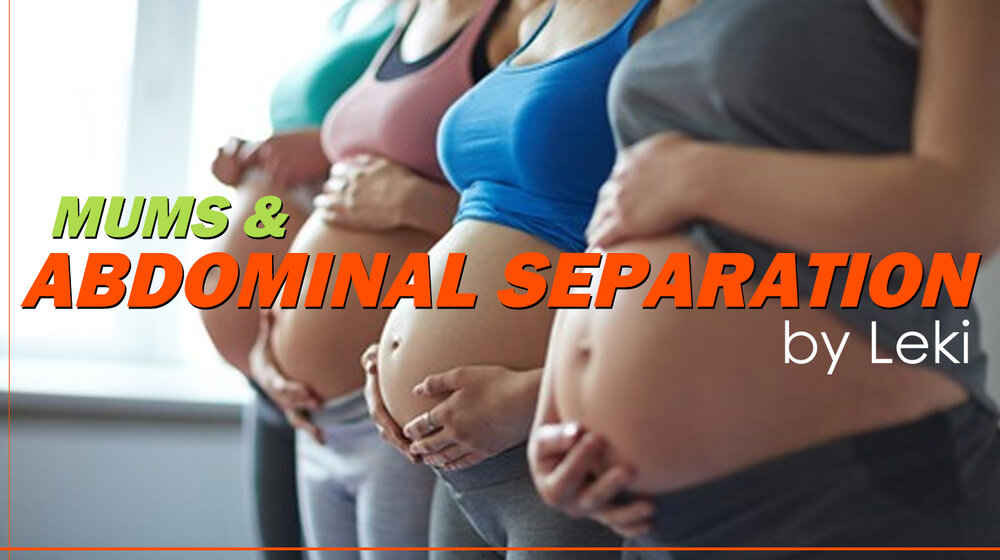Abdominal Separation (diastasis recti) - The Active Mother